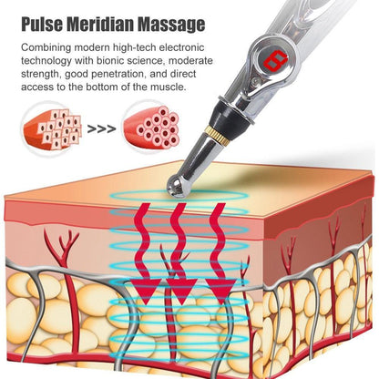 Electric Acupuncture Point Massage Pen - Luren Store
